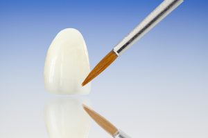 dental veneers, dental crowns, white teeth, porcelain veneers