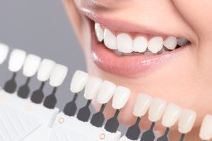 teeth whitening, teeth cleaning