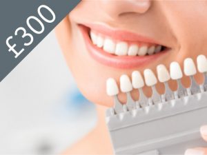 Enlighten Teeth Whitening Watford